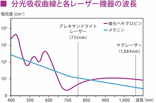 アレキサンドライトレーザーとヤグレーザーの比較表